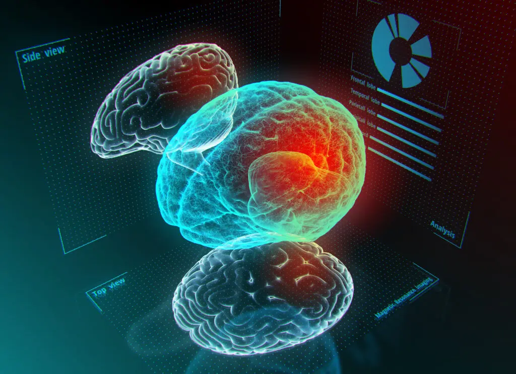 image du cerveau en 3D